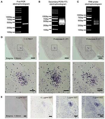 A PCR-Based Method for RNA Probes and Applications in Neuroscience